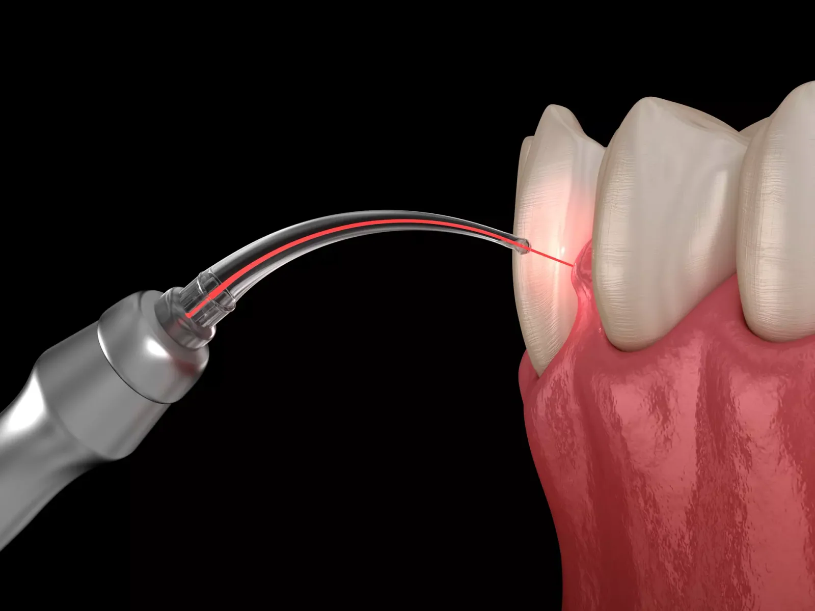 Why Your Gums Bleed When You Floss